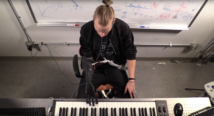 ‘Luke Skywalker’ Prosthesis Controls Fingers and Plays Piano
